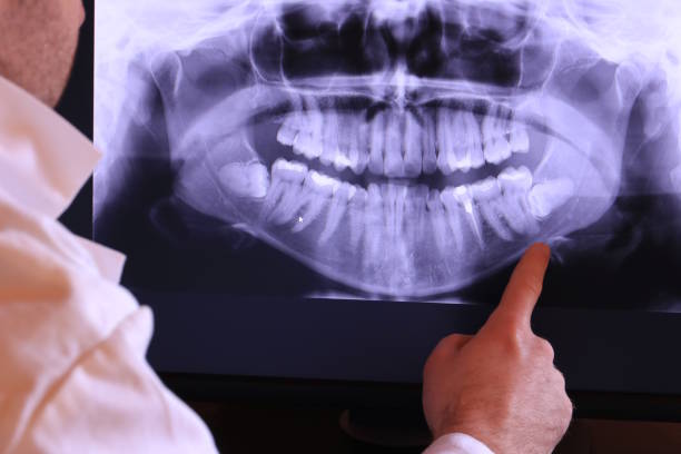 Best Weekend Emergency Dental Services in Weaverville, CA