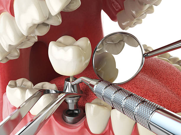 Best Emergency Treatment for Oral Infections in Weaverville, CA
